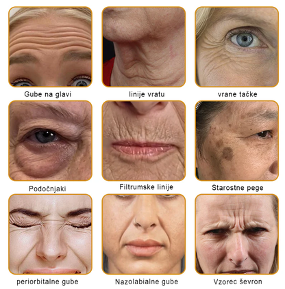 👩‍⚕️Sinvie® krema s čebeljim strupom | 50 ml | Profesionalna formula za nego in obnovo kože