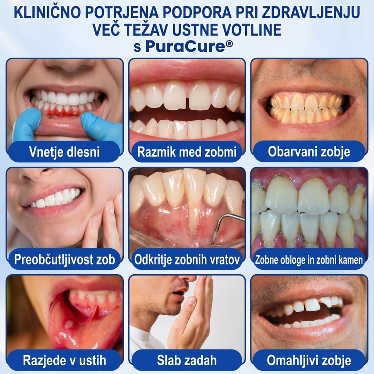 🇸🇮👨‍⚕️✅🦷 PuraCure® OBNOVITVENI GEL ZA DLESNI – Parodontalni obnovitveni gel🧂