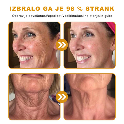 🎁Sinvie® Na voljo je samo še 5 škatel! Zagotovite si dodatnih 50 % popusta.    Če zamudite zdaj, takšne priložnosti prihodnje leto morda ne bo več.