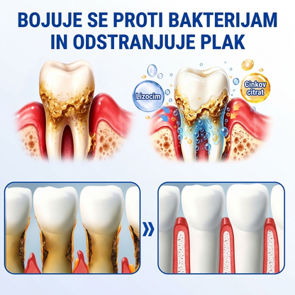 🇸🇮👨‍⚕️✅🦷 PuraCure® OBNOVITVENI GEL ZA DLESNI – Parodontalni obnovitveni gel🧂