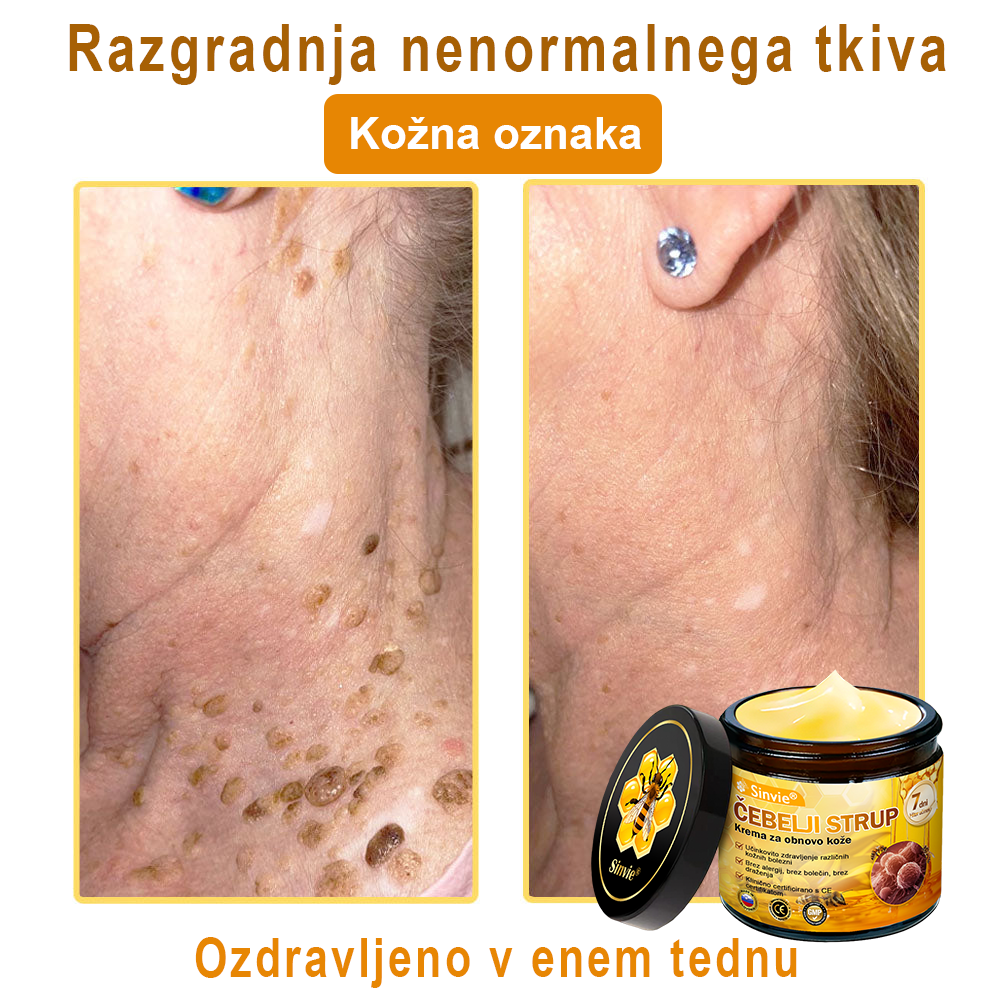 👩‍⚕️Sinvie® krema s čebeljim strupom | 50 ml | Profesionalna formula za nego in obnovo kože