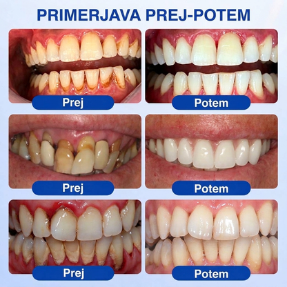 🇸🇮👨‍⚕️✅🦷 PuraCure® OBNOVITVENI GEL ZA DLESNI – Parodontalni obnovitveni gel🧂