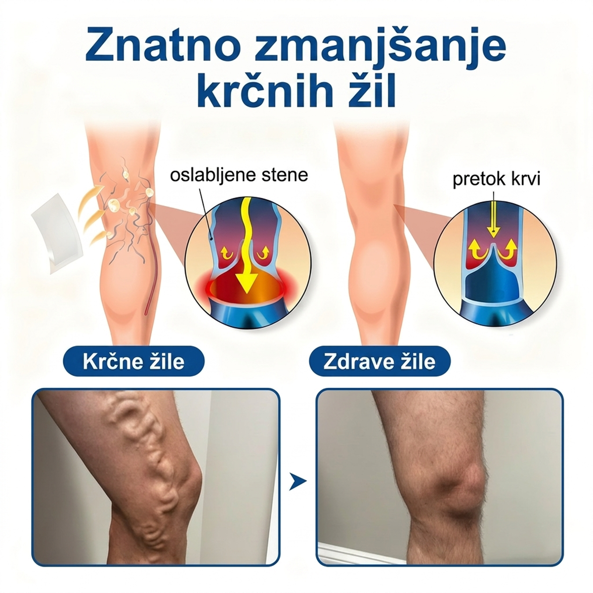 ✅ Medistart® Mikroiglični obliž za nego krčnih žil ⚡ Takojšnje olajšanje, dolgotrajni učinki