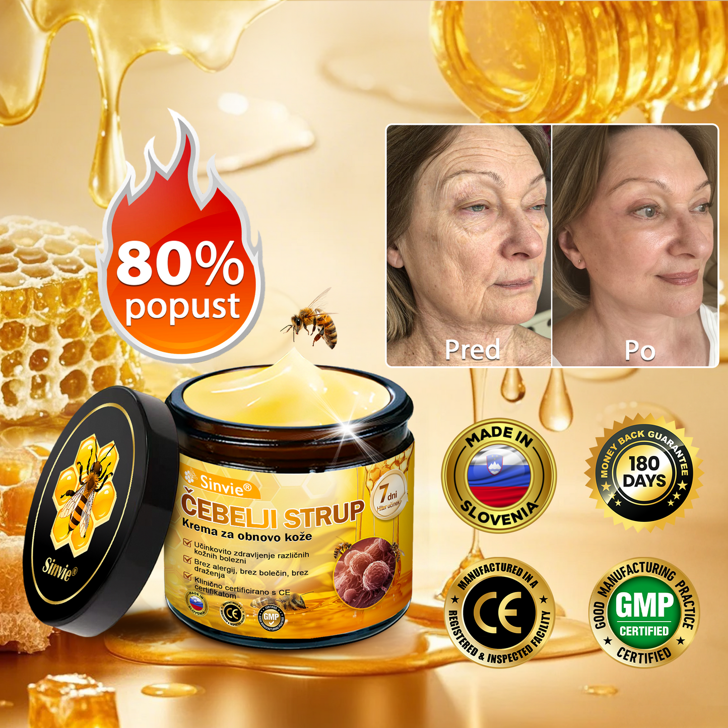 👩‍⚕️Sinvie® krema s čebeljim strupom | 50 ml | Profesionalna formula za nego in obnovo kože