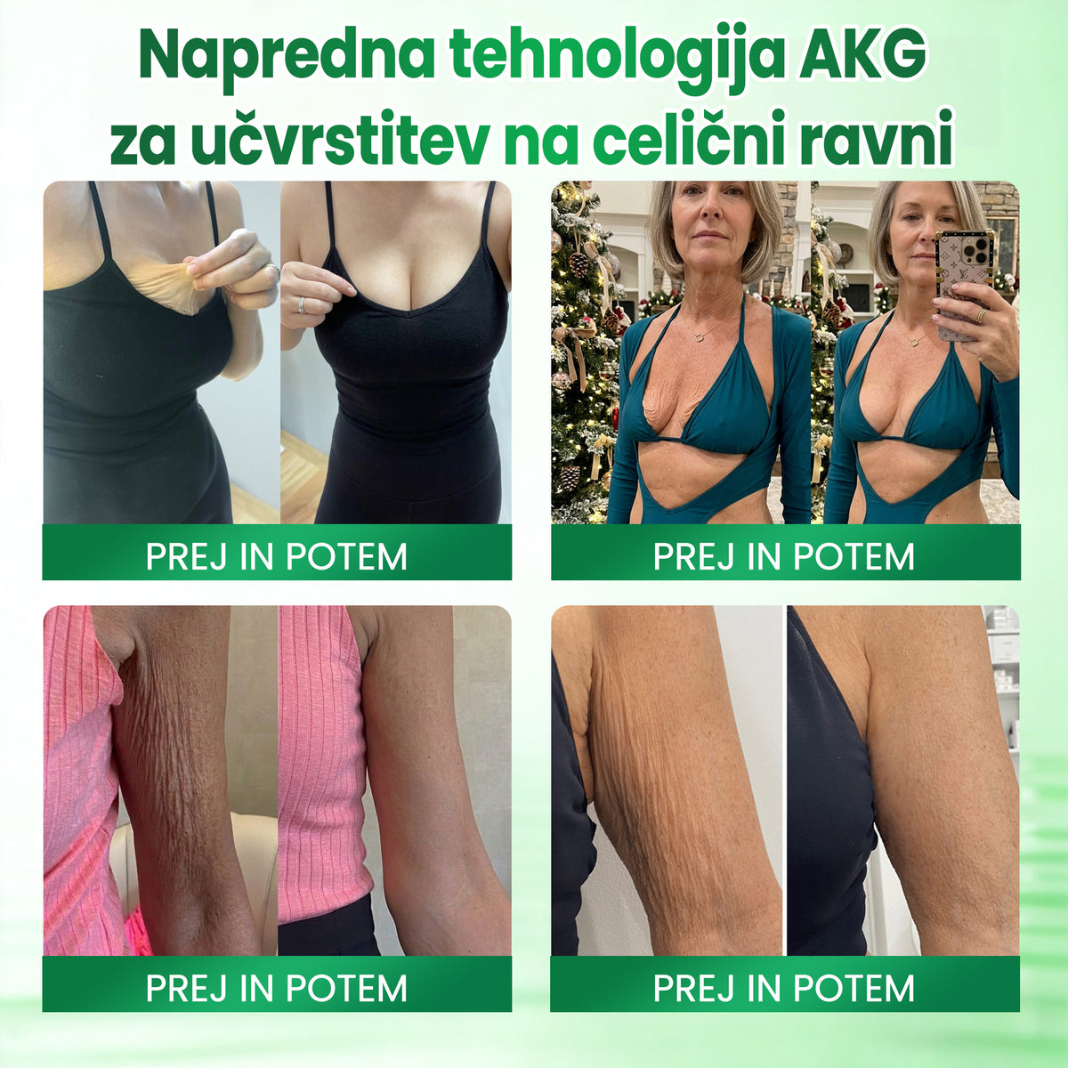 ✅✅✅✅✅Medistart® AKG – Učvrstitvena nega kože proti znakom staranja
