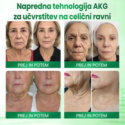 ✅✅✅✅✅Medistart® AKG – Učvrstitvena nega kože proti znakom staranja