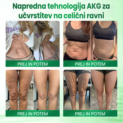 ✅✅✅✅✅Medistart® AKG – Učvrstitvena nega kože proti znakom staranja