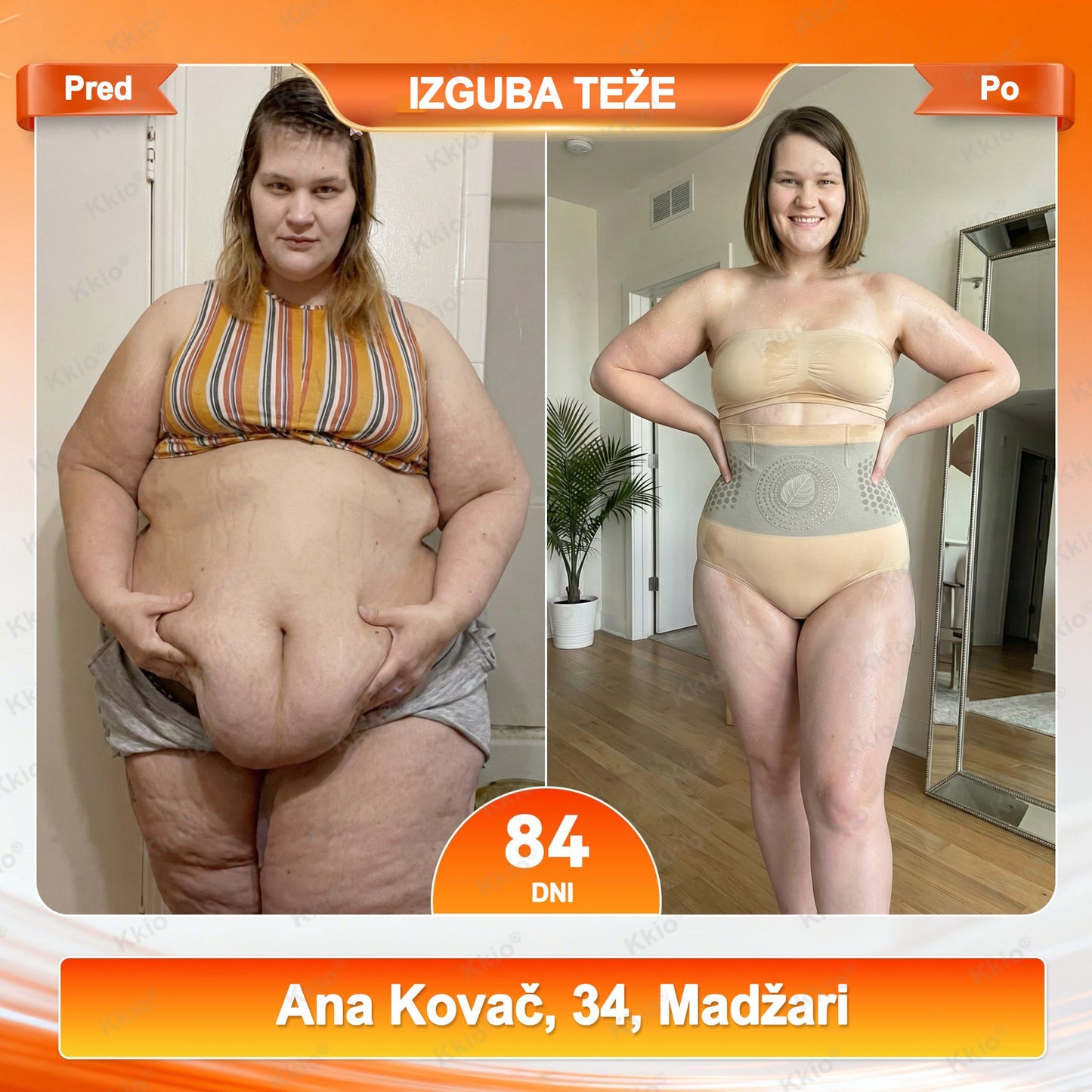 📢 Odkrij TikTok trend – nova Kkio®👩 4 serija 1️⃣ Kratke hlače za preoblikovanje telesa in izgubo maščobe, 2️⃣ Mikro kratke hlače z Moringo in Berberinom ☘️ ✅ Na voljo samo v uradni spletni trgovini | Originalni izdelek