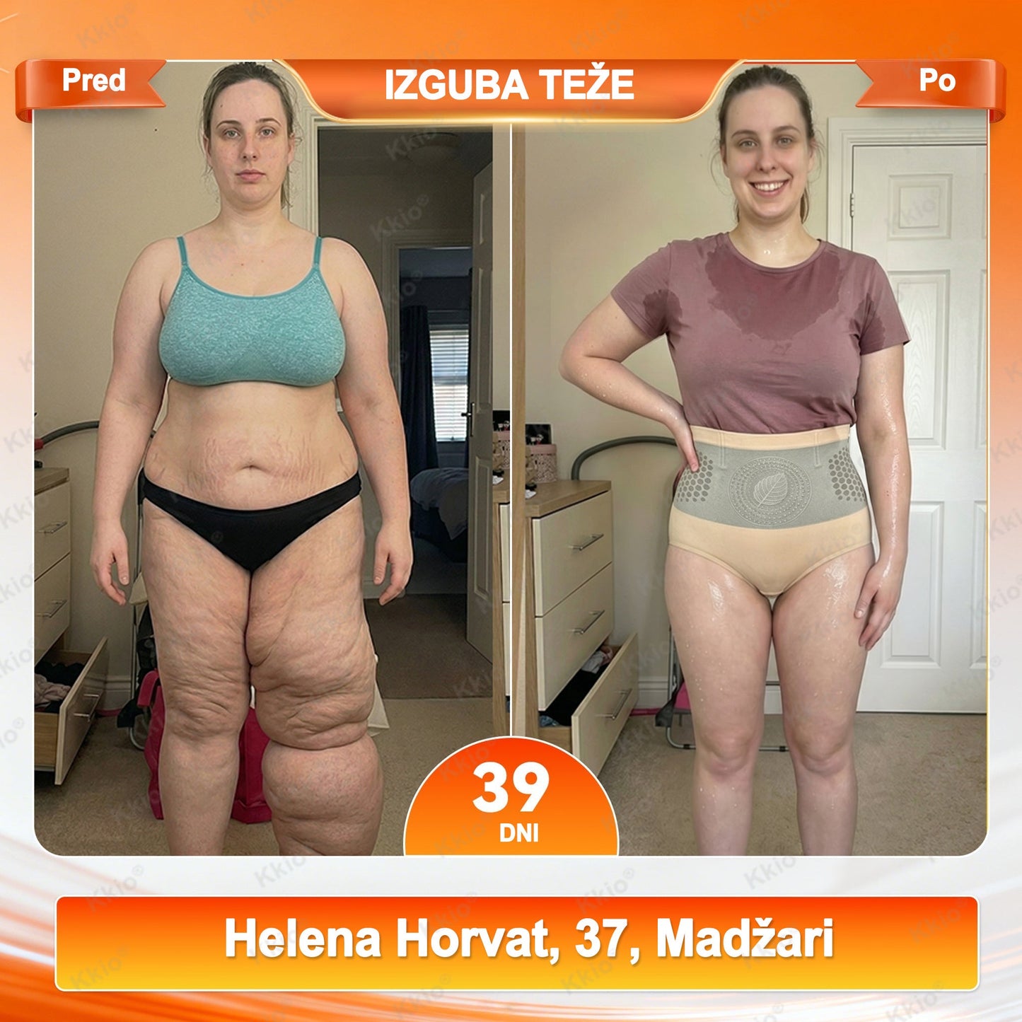 📢 Odkrij TikTok trend – nova Kkio®👩 4 serija 1️⃣ Kratke hlače za preoblikovanje telesa in izgubo maščobe, 2️⃣ Mikro kratke hlače z Moringo in Berberinom ☘️ ✅ Na voljo samo v uradni spletni trgovini | Originalni izdelek