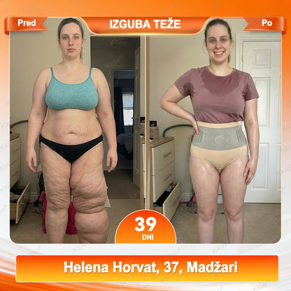 📢 Odkrij TikTok trend – nova Kkio®👩 4 serija 1️⃣ Kratke hlače za preoblikovanje telesa in izgubo maščobe, 2️⃣ Mikro kratke hlače z Moringo in Berberinom ☘️ ✅ Na voljo samo v uradni spletni trgovini | Originalni izdelek