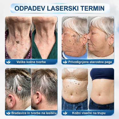 PuraCure®👩‍⚕️ 👩‍⚕️👩‍⚕️Rezultati so vidni že v 7 dneh! Valjček za odstranjevanje bradavic in drugih kožnih težav | Neboleče in minimalno razmaže.