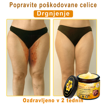 📢Sinvie® krema s čebeljim strupom | 50 ml | Profesionalna formula za nego in obnovo kože