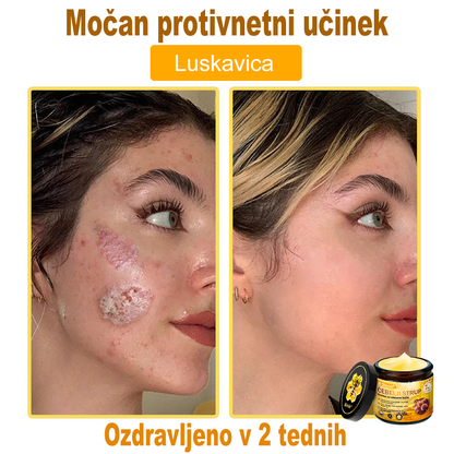 👩‍⚕️Sinvie® krema s čebeljim strupom | 50 ml | Profesionalna formula za nego in obnovo kože
