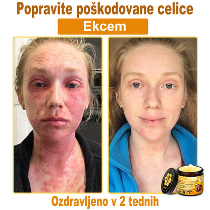 📢Sinvie® krema s čebeljim strupom | 50 ml | Profesionalna formula za nego in obnovo kože