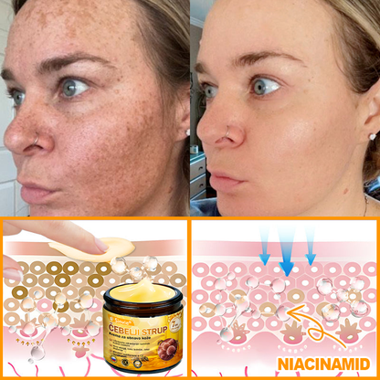 📢Sinvie® krema s čebeljim strupom | 50 ml | Profesionalna formula za nego in obnovo kože