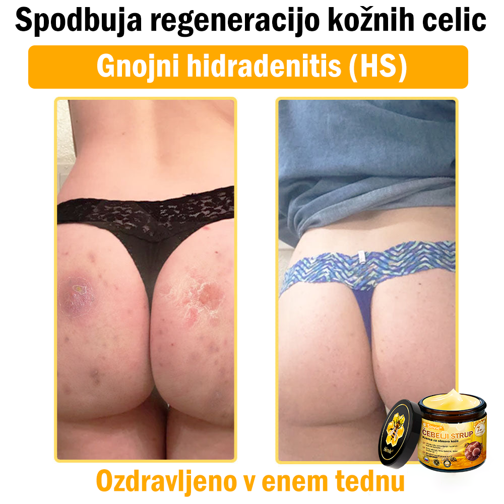 📢Sinvie® krema s čebeljim strupom | 50 ml | Profesionalna formula za nego in obnovo kože