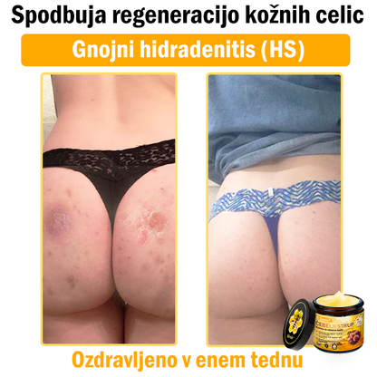 📢Sinvie® krema s čebeljim strupom | 50 ml | Profesionalna formula za nego in obnovo kože